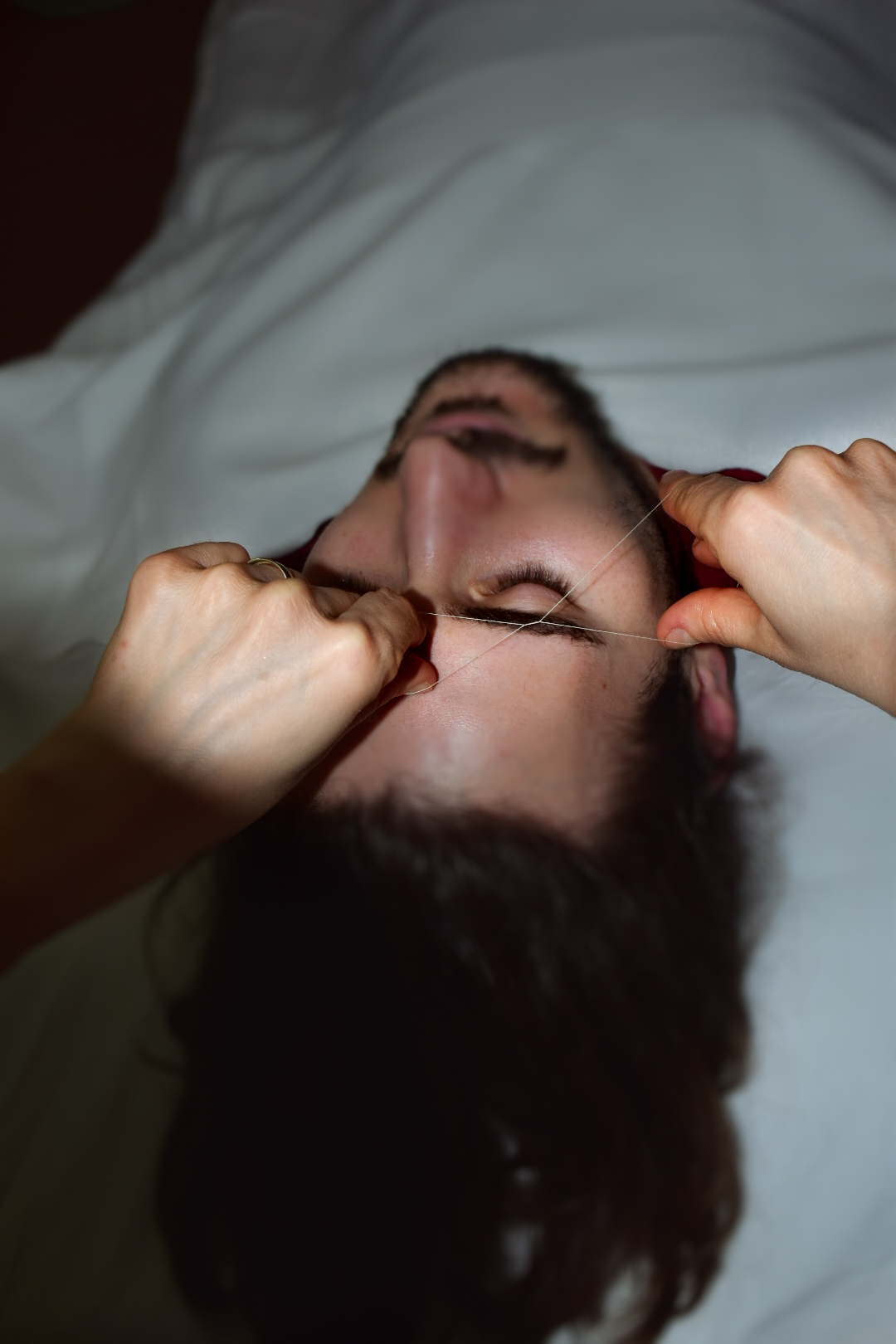 Fadentechnik Behandlung